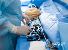 全面科普解答，输卵管造影价格及费用详解